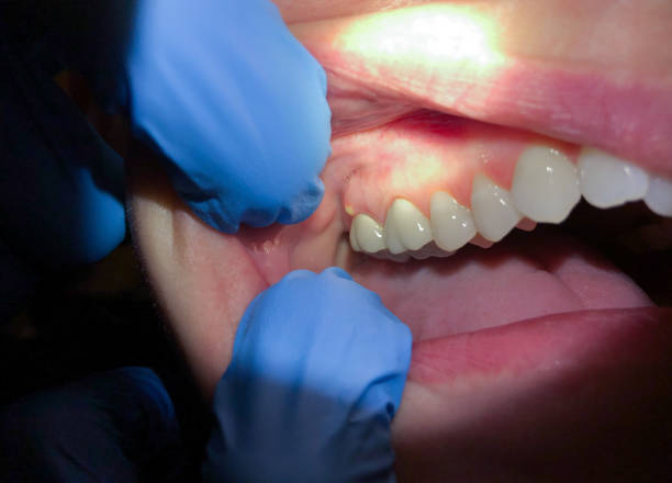 Best Broken Tooth Emergency  in Mondovi, WI